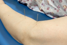 无锡国济康复医院中医康复，以传统技法护佑身心安康