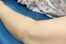 夏季经常“头晕目眩”?无锡国济康复中医科帮你轻松应对