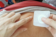 调阴阳，和气血，治未病！无锡国济康复医院三伏贴敷正当时